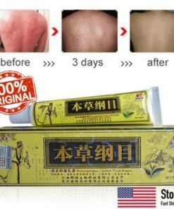 Avanceret psoriasis og eksem naturlig urtecreme