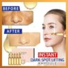 Øjeblikkelig Dark Spot Lifting Ampule
