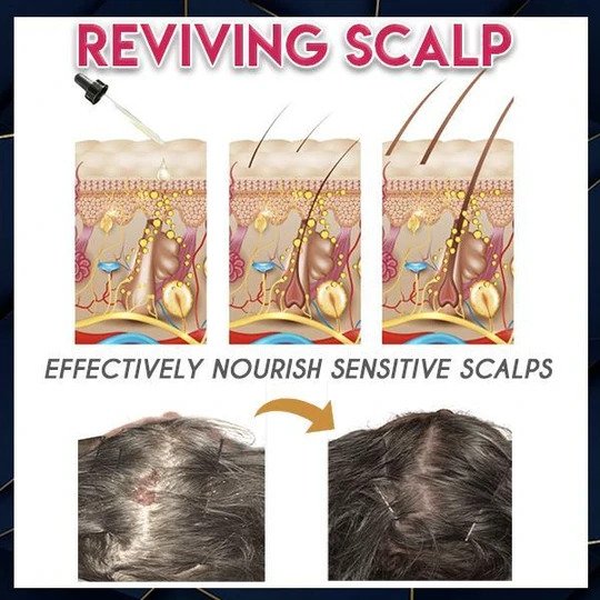 Pure Grow Hair Growth Essence - Image 2