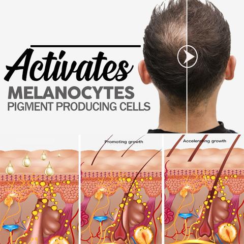 Hair Growth Shampoo Bar - Image 3