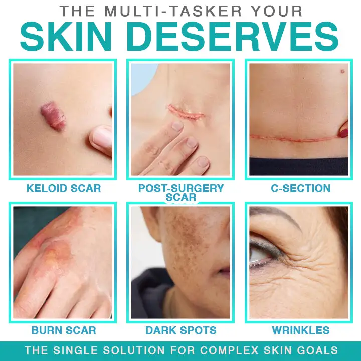 𝗖𝗮𝗿𝗲𝗕𝗿𝗲𝗲𝘇𝗲® 3-i-1 Microneedle Care Patch - Image 2