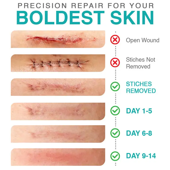 𝗖𝗮𝗿𝗲𝗕𝗿𝗲𝗲𝘇𝗲® 3-i-1 Microneedle Care Patch - Image 4