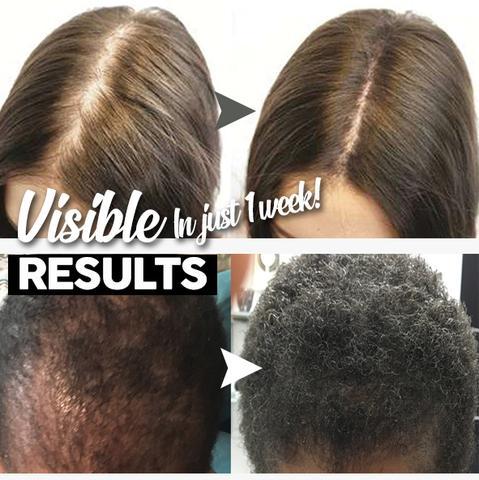 Hair Growth Shampoo Bar - Image 4