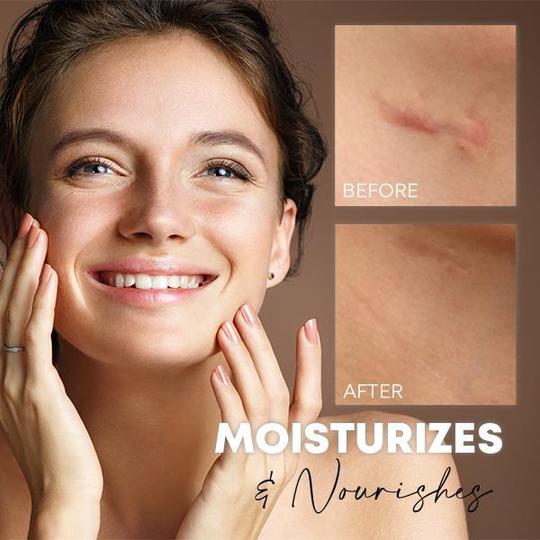 Medease Skin Rebound Cream - Image 4