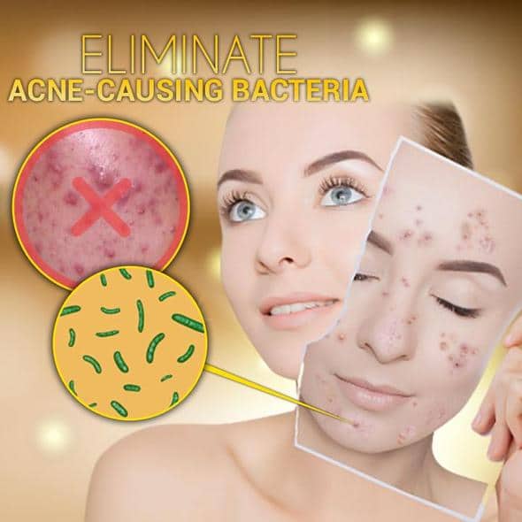 SkinClear Clarifying Maskne Spray - Image 3