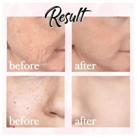 Perfekt Base Mat Poreless Primer - Image 4