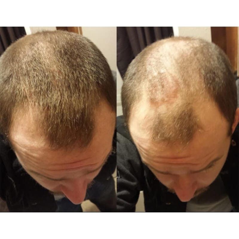 Hårbyggefibre - Image 5