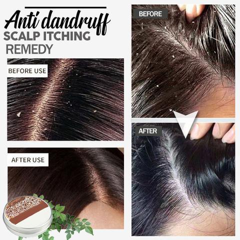 Hair Growth Shampoo Bar - Image 5