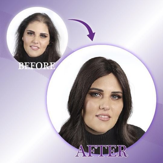 Silkeagtig Clip On Hair Topper - Image 6