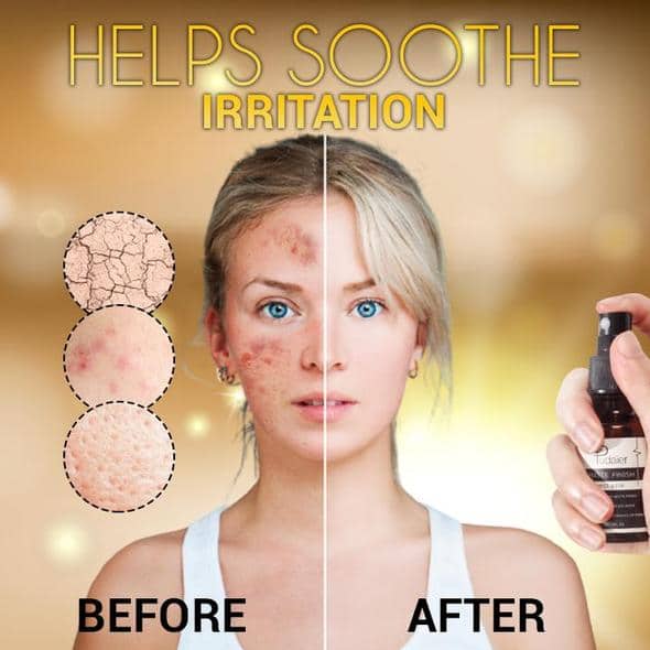 SkinClear Clarifying Maskne Spray - Image 7