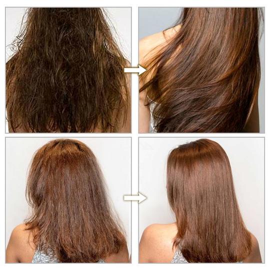 Hairacle Vitamin Serum Kapsel - Image 9