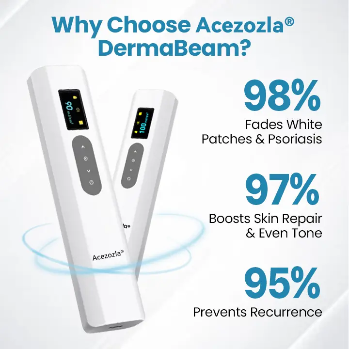 Acezozla® DermaBeam Vitiligo Therapy Device - Image 6