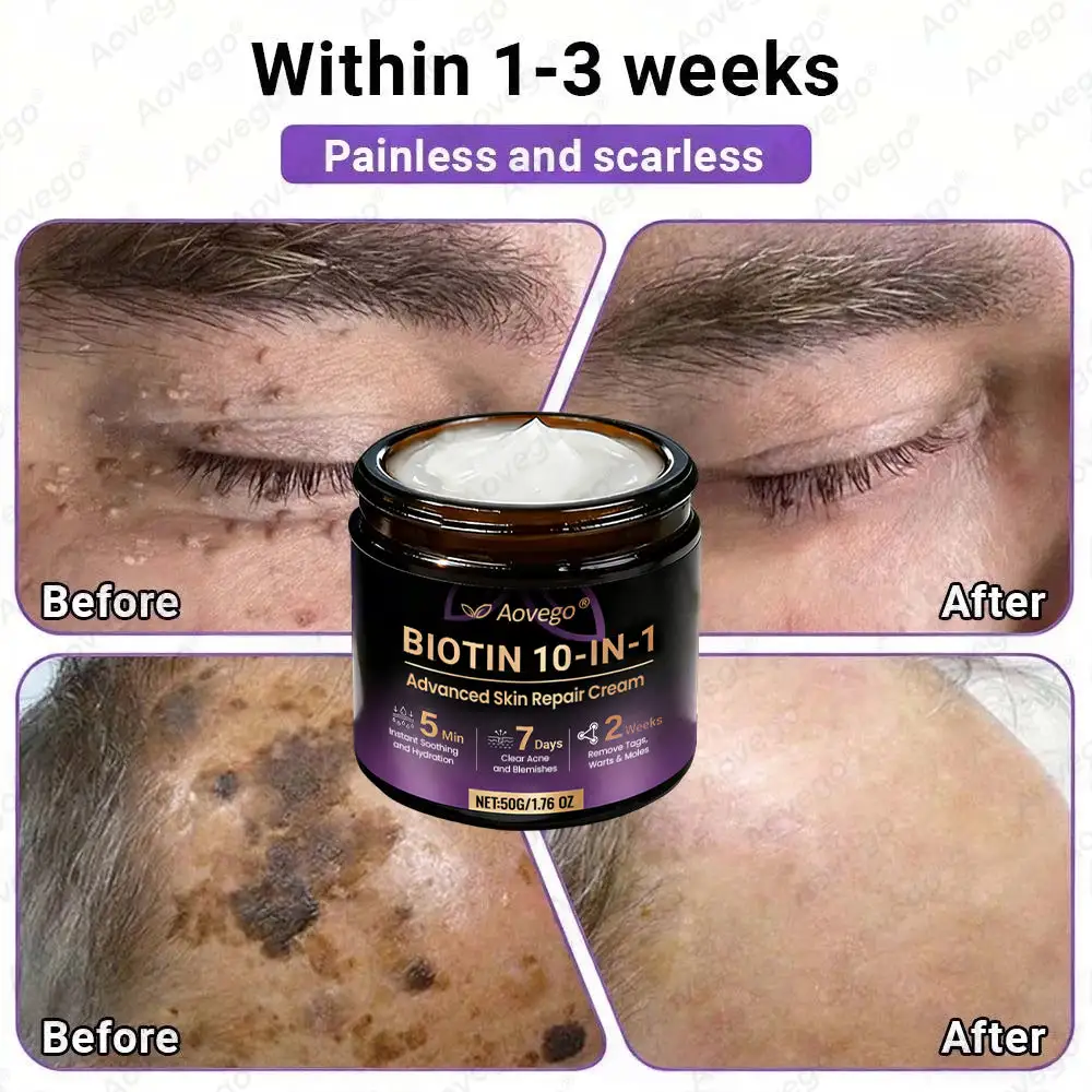 Aovego® BIOTIN 10-IN-1 Advanced Skin Repair Cream - Image 10