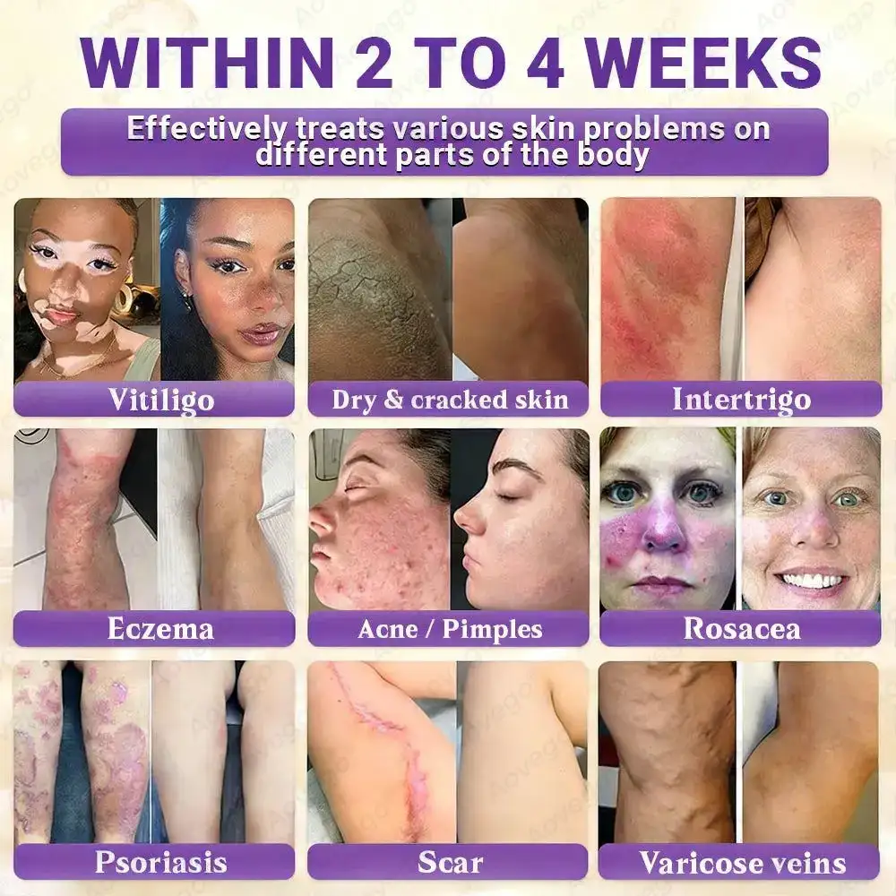 Aovego® BIOTIN 10-IN-1 Advanced Skin Repair Cream - Image 2