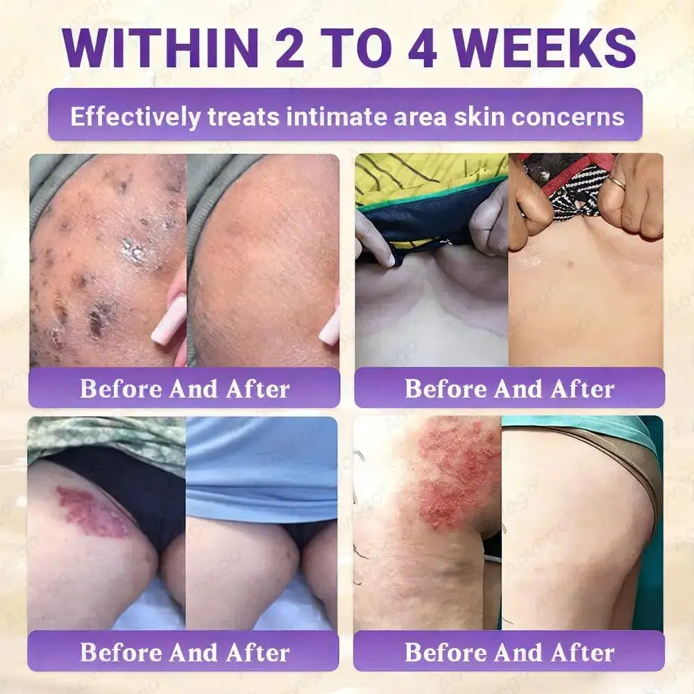 Aovego® BIOTIN 10-IN-1 Advanced Skin Repair Cream - Image 3