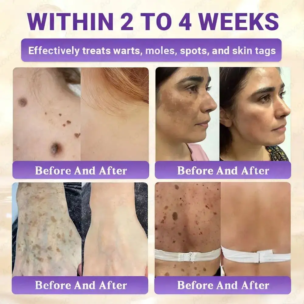 Aovego® BIOTIN 10-IN-1 Advanced Skin Repair Cream - Image 4