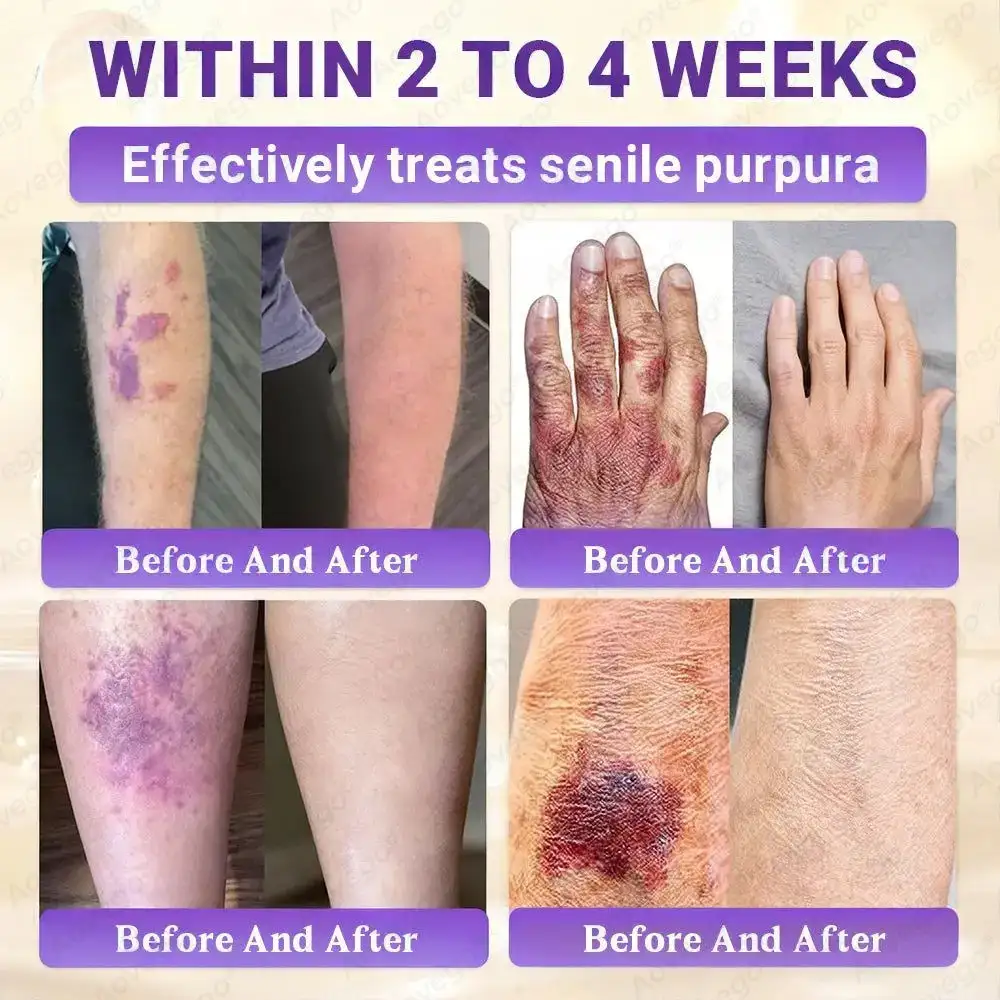 Aovego® BIOTIN 10-IN-1 Advanced Skin Repair Cream - Image 7