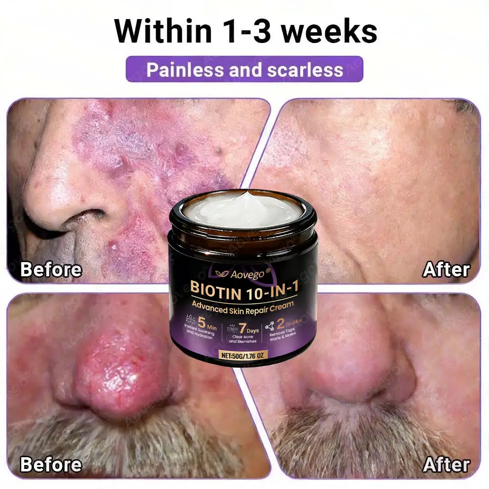 Aovego® BIOTIN 10-IN-1 Advanced Skin Repair Cream - Image 8