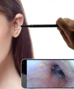 Endoskop øreplukkerkamera